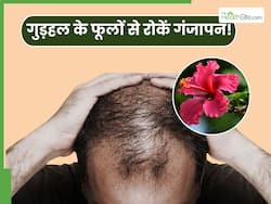 नारियल तेल में गुड़हल के फूलों को मिलाकर लगाने से गंजेपन की हो जाएगी छुट्टी, ऐसे करें प्रयोग