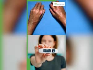 हाथों में नजर आते हैं हाई ब्लड शुगर बढ़ने के ये 7 लक्षण