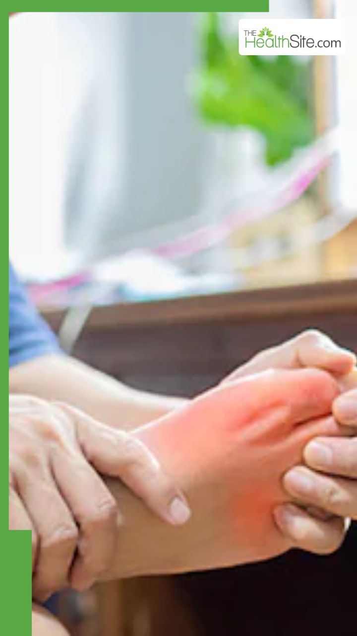 यूरिक एसिड के शुरुआती लक्षण