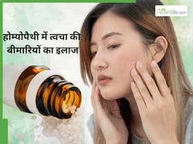 होम्योपैथी में त्वचा से जुड़ी समस्याओं का इलाज कैसे किया जाता है, जिससे ठीक हो जाती हैं मुंहासों और विटिलिगो की समस्या