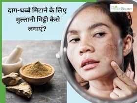 चेहरे के दाग-धब्बे मिटाने के लिए मुल्तानी मिट्टी कैसे लगाएं? जानें 5 तरीके, जिनसे आएगा त्वचा पर निखार