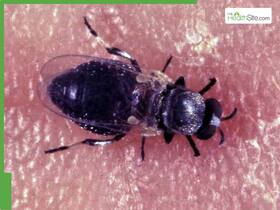 WHO Recognises Niger As The First African Country To Eliminate Infectious Parasitic Disease Onchocerciasis WHO Recognises Niger As The First African Country To Eliminate Infectious Parasitic Disease Onchocerciasis