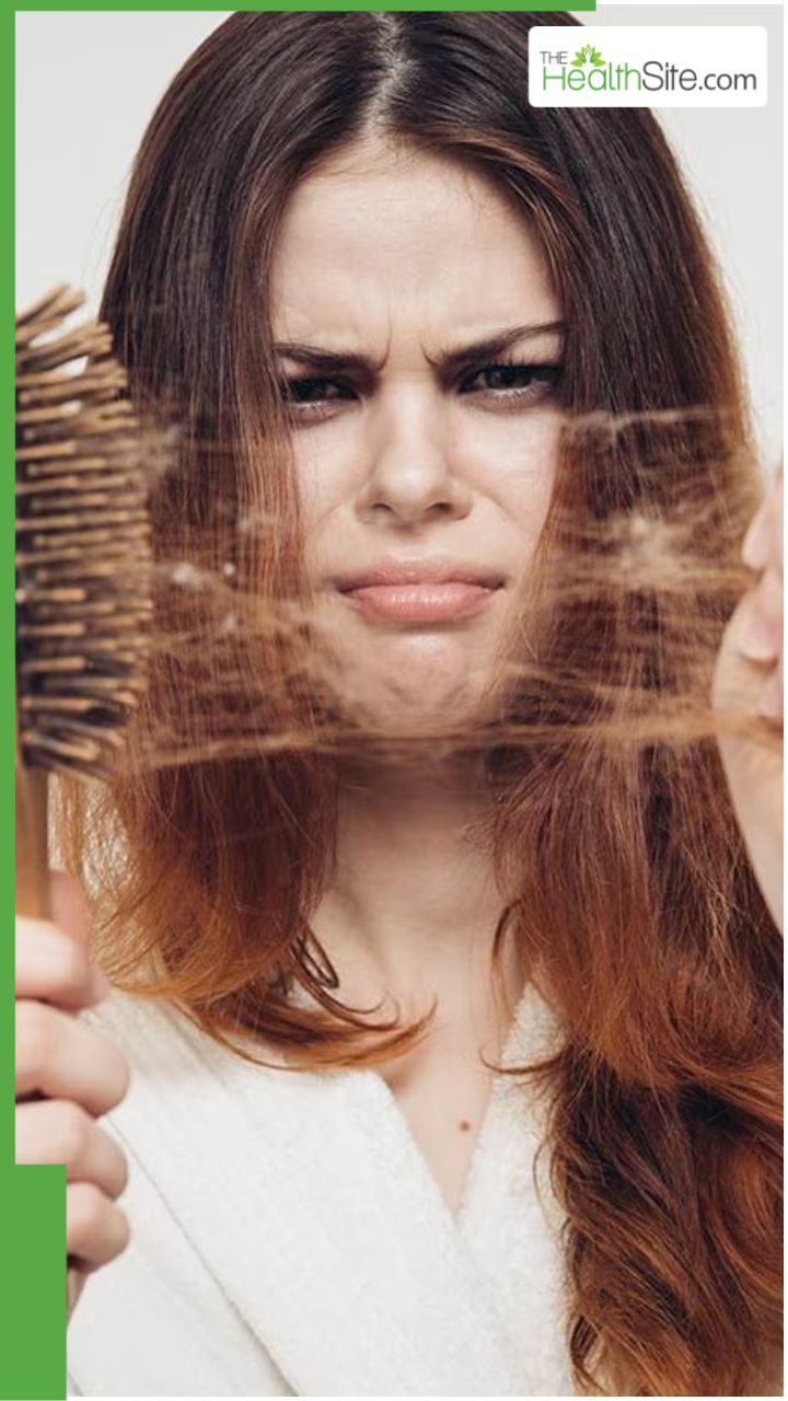 सर्दियों में हेयरफॉल रोकने के 8 नेचुरल तरीके