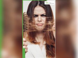 सर्दियों में हेयरफॉल रोकने के 8 नेचुरल तरीके