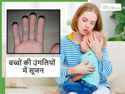 क्या ठंड में आपके बच्चों की उंगलियों में तो नहीं हो रही सूजन? इसके पीछे के कारणों गलती से भी न करें इग्नोर
