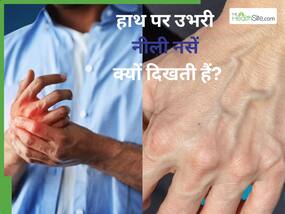 हाथ पर उभरी हुई नीली नसें क्यों दिखती हैं? इन 5 कारणों से नजर आ सकती हैं नीली नसें
