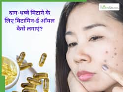 चेहरे के दाग-धब्बे मिटाने के लिए विटामिन-ई कैप्सूल कैसे लगाएं? जानें 4 तरीके, जिनसे कम हो जाएंगे डार्क स्पॉट्स