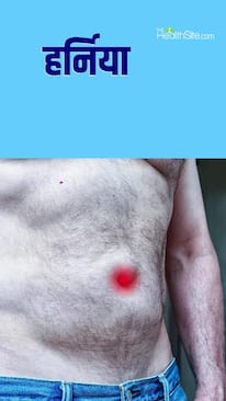 जानें क्या है हर्निया होने का कारण, ऐसे होगा बचाव?