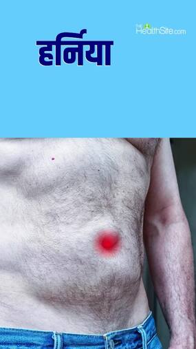 Hernia symptoms and preventions