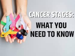 World Cancer Day 2025 Exclusive: What You Need to Know About Cancer Stages     Oncologist Explains