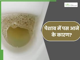 इन 5 बीमारियों के कारण पेशाब में आने लगता है पस, लक्षणों को पहचानकर जाएं डॉक्टर के पास