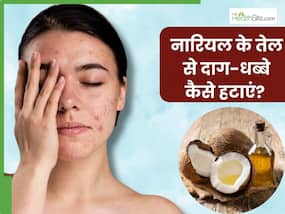 चेहरे के दाग-धब्बे हटाने के लिए नारियल तेल में मिलाकर लगाएं ये 3 चीजें, निखर जाएगी त्वचा