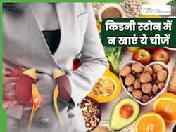 किडनी स्टोन के मरीज भूलकर भी न खाएं 5 फूड्स, बढ़ सकता है दर्द और पथरी का साइज