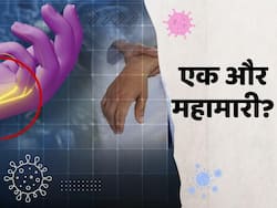 पुणे में वायरस से लगातार मौत, क्या Guillain barre syndrome है नई महामारी?