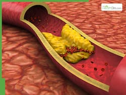 Healthy Heart Signs: 7 Key Indicators You Don't Have High Cholesterol Levels