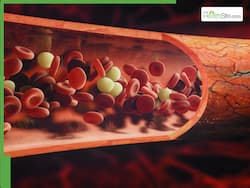 High Cholesterol Prevention: 5 Winter Superfoods To Flush Out Bad LDL Cholesterol Naturally