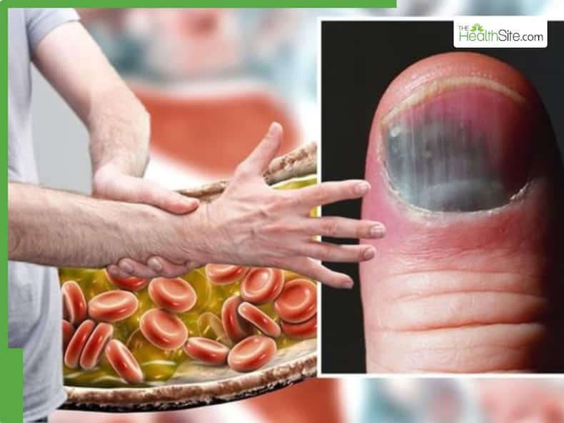 thehealthsite.com top news