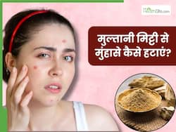मुल्तानी मिट्टी से पिंपल्स कैसे हटाएं? जानें 3 तरीके, जिनसे मिलेगा कील-मुंहासों से छुटकारा