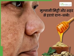चेहरे से दाग-धब्बे हटाने के लिए मुल्तानी मिट्टी और शहद कैसे लगाएं? जानिए आसान तरीका