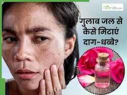 चेहरे के दाग-धब्बों से परेशान हैं, तो गुलाब जल में मिलाकर लगाएं ये 3 चीजें, मिट जाएगा सारा कालापन