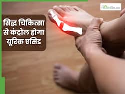 सिद्ध चिकित्सा से करें यूरिक एसिड का इलाज, इन जड़ी-बूटियों के सेवन से मिलेगा जल्द आराम