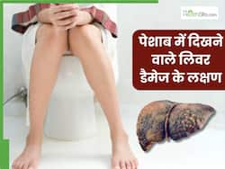 पेशाब का ऐसा रंग लिवर डैमेज का हो सकता है संकेत, इग्नोर करना पड़ सकता है भारी