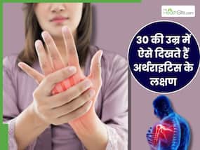 30 की उम्र में इस तरह दिखते हैं अर्थराइटिस के लक्षण, घुटने हिलाने पर आती है क्लिक और पॉपिंग की आवाज