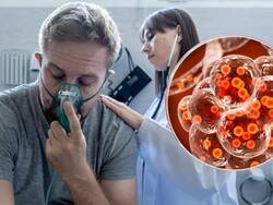 US Flu Season Claimed 13,000 Lives And Infected 24 Million, CDC Declares It The Worst In 15 Years