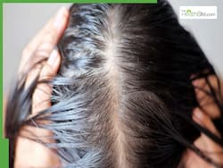 What Causes Sudden Hair Fall? When To See A Dermatologist