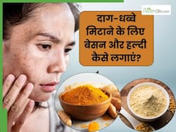 चेहरे के दाग-धब्बे मिटाने के लिए बेसन और हल्दी कैसे लगाएं? जानें 5 तरीके, जिनसे मिट जाएंगे जिद्दी काले धब्बे