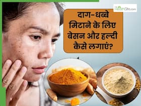 चेहरे के दाग-धब्बे मिटाने के लिए बेसन और हल्दी कैसे लगाएं? जानें 5 तरीके, जिनसे मिट जाएंगे जिद्दी काले धब्बे