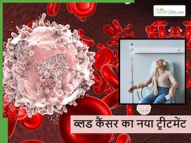 इलाज के बाद भी जान का खतरा बना रहता है Blood Cancer के मरीजों में? लक्षण और इलाज की समझ बहुत जरूरी इलाज के बाद भी जान का खतरा बना रहता है Blood Cancer के मरीजों में? लक्षण और इलाज की समझ बहुत जरूरी