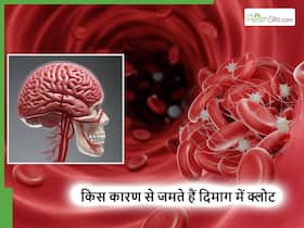 इन 5 कारणों से दिमाग में जमने लगते हैं खून के थक्के, इग्नोर किया तो हो सकती है हार्ट अटैक का खतरा इन 5 कारणों से दिमाग में जमने लगते हैं खून के थक्के, इग्नोर किया तो हो सकती है हार्ट अटैक का खतरा