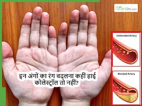 Bad Cholesterol बढ़ने पर सबसे पहले शरीर के ये अंग बदलने लगते हैं रंग, हार्ट अटैक से पहले ही कर लें पहचान