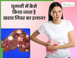यूनानी मेडिसिन में खराब लिवर को कैसे ठीक किया जाता है? जानें 5 नेचुरल उपाय, जिनसे लिवर हेल्थ बनती है बेहतर