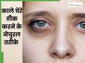 आंखों के नीचे काले घेरों को दूर करती हैं किचन की ये 4 चीजें, लगाने से मिट जाते हैं डार्क सर्कल्स