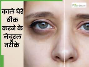 आंखों के नीचे काले घेरों को दूर करती हैं किचन की ये 4 चीजें, लगाने से मिट जाते हैं डार्क सर्कल्स