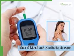 स्किन में दिख रहे ये 5 लक्षण भी बताएंगे आपको हो गया है डायबिटीज, ज्यादातर लोग कर देते हैं इग्नोर