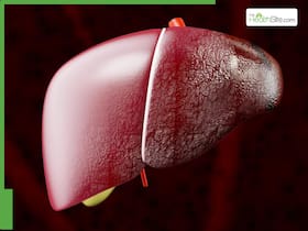 Tips To Prevent Liver Diseases: 4 Food Groups That Are Accelerating Liver Damage Tips To Prevent Liver Diseases: 4 Food Groups That Are Accelerating Liver Damage
