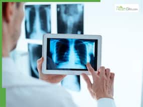 What Makes Molecular Profiling And Genetic Testing Game Changers In Lung Cancer Treatment?