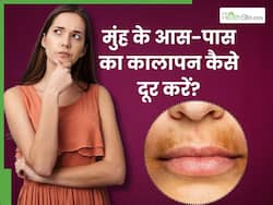 मुंह के आस-पास का कालापन मिटाने के लिए अपनाएं ये 4 घरेलू उपाय, टैनिंग और दाग-धब्बों से मिल जाएगा छुटकारा