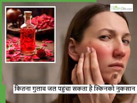ज्यादा गुलाब जल लगाना स्किन को पहुंचा सकता है ये 5 डैमेज, जानें कितना Rose Water आपकी स्किन के लिए सेफ