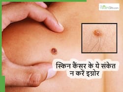 Skin Cancer का संकेत हो सकते हैं त्वचा में मामूली से दिखने वाले ये 5 लक्षण, ज्यादातर लोग कर देते हैं इग्नोर