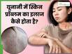 यूनानी मेडिसिन में त्वचा संबंधी समस्याओं को कैसे ठीक किया जाता है? जानें 5 कारगर उपाय