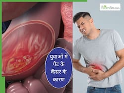 इन 5 कारणों से युवाओं में बढ़ रहे हैं पेट में कैंसर के मामले, बचाव के लिए अपनाएं जरूरी टिप्स