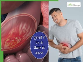 इन 5 कारणों से युवाओं में बढ़ रहे हैं पेट में कैंसर के मामले, बचाव के लिए अपनाएं जरूरी टिप्स इन 5 कारणों से युवाओं में बढ़ रहे हैं पेट में कैंसर के मामले, बचाव के लिए अपनाएं जरूरी टिप्स