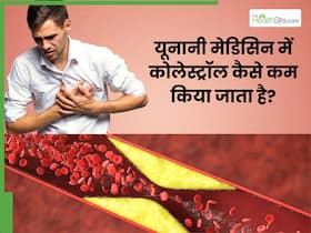 कोलेस्ट्रॉल नॉर्मल करने के लिए यूनानी मेडिसिन से बेहतर कुछ नहीं, जड़ से साफ होगा Bad Cholesterol