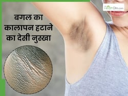 बगल का कालापन हटाने के लिए 1 बार जरूर ट्राई करें ये देसी तरीका, हफ्तेभर में चमक जाएंगे अंडरआर्म्स