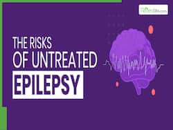 World Epilepsy Day 2025: Advanced Treatments And Multidisciplinary Approaches To Combat Epilepsy