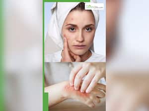 स्किन एलर्जी और खुजली होने के 10 बड़े कारण